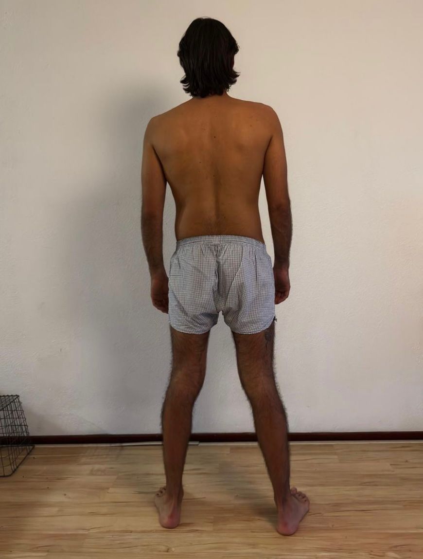 Antes